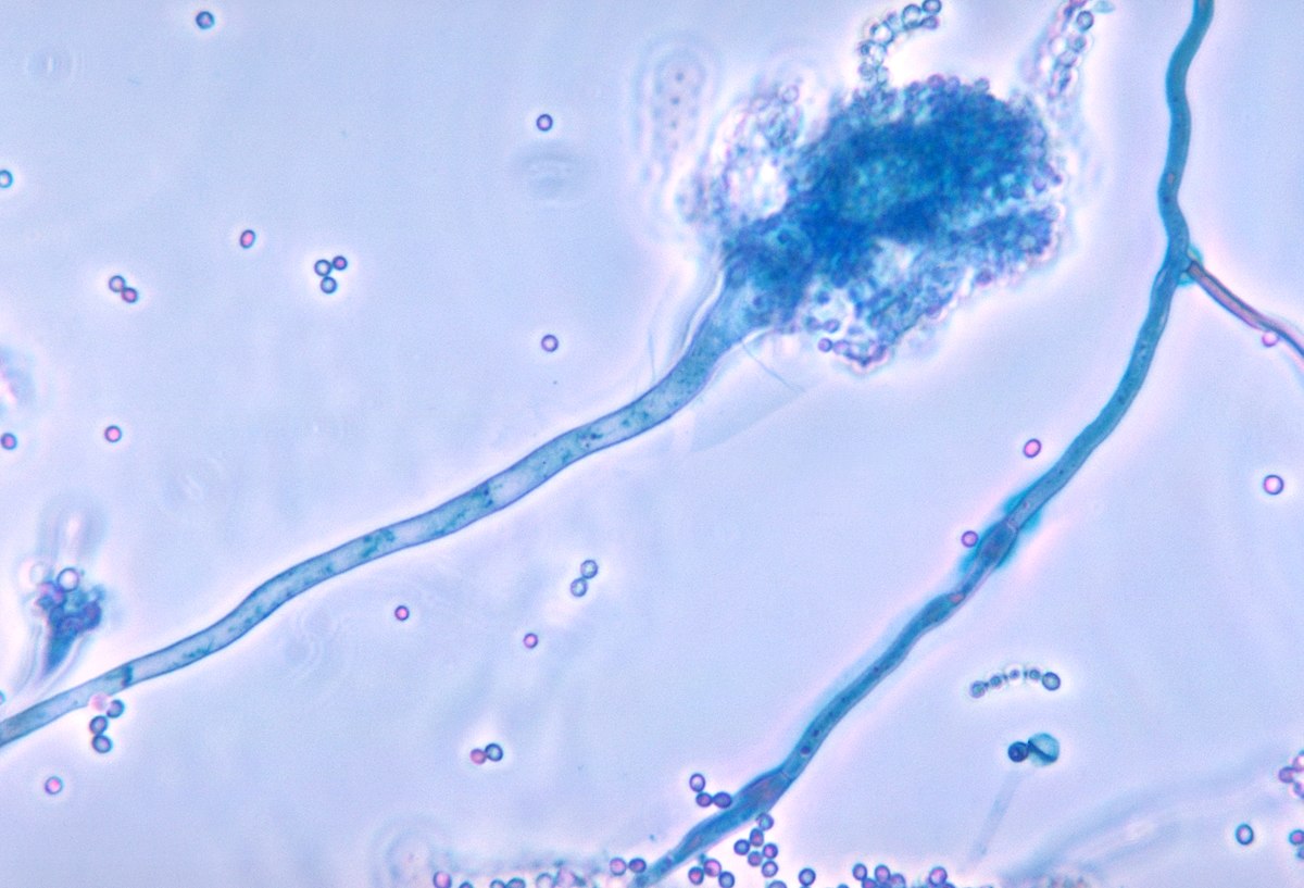 Aspergillus niger, a bioleaching fungus.