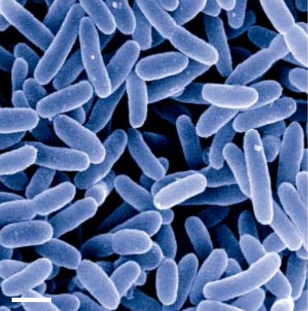 Dechloromonas strain RCB, perchlorate reducing bacteria.