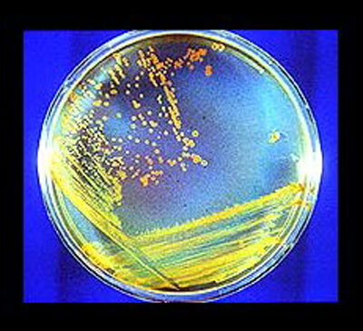 D. radiodurans, a so-called extremophile, here on Earth