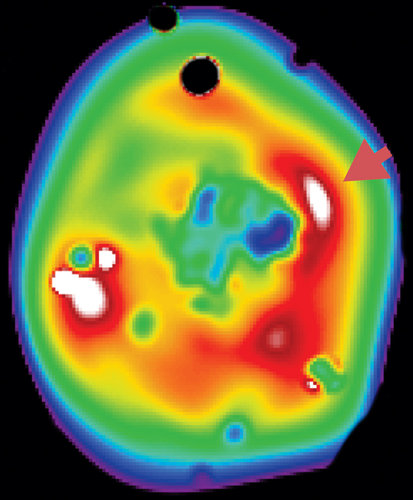 XMM-Newton image of galaxy cluster RXCJ0658.5-5556