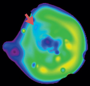 XMM-Newton image of galaxy cluster RXCJ 0232.2-4420