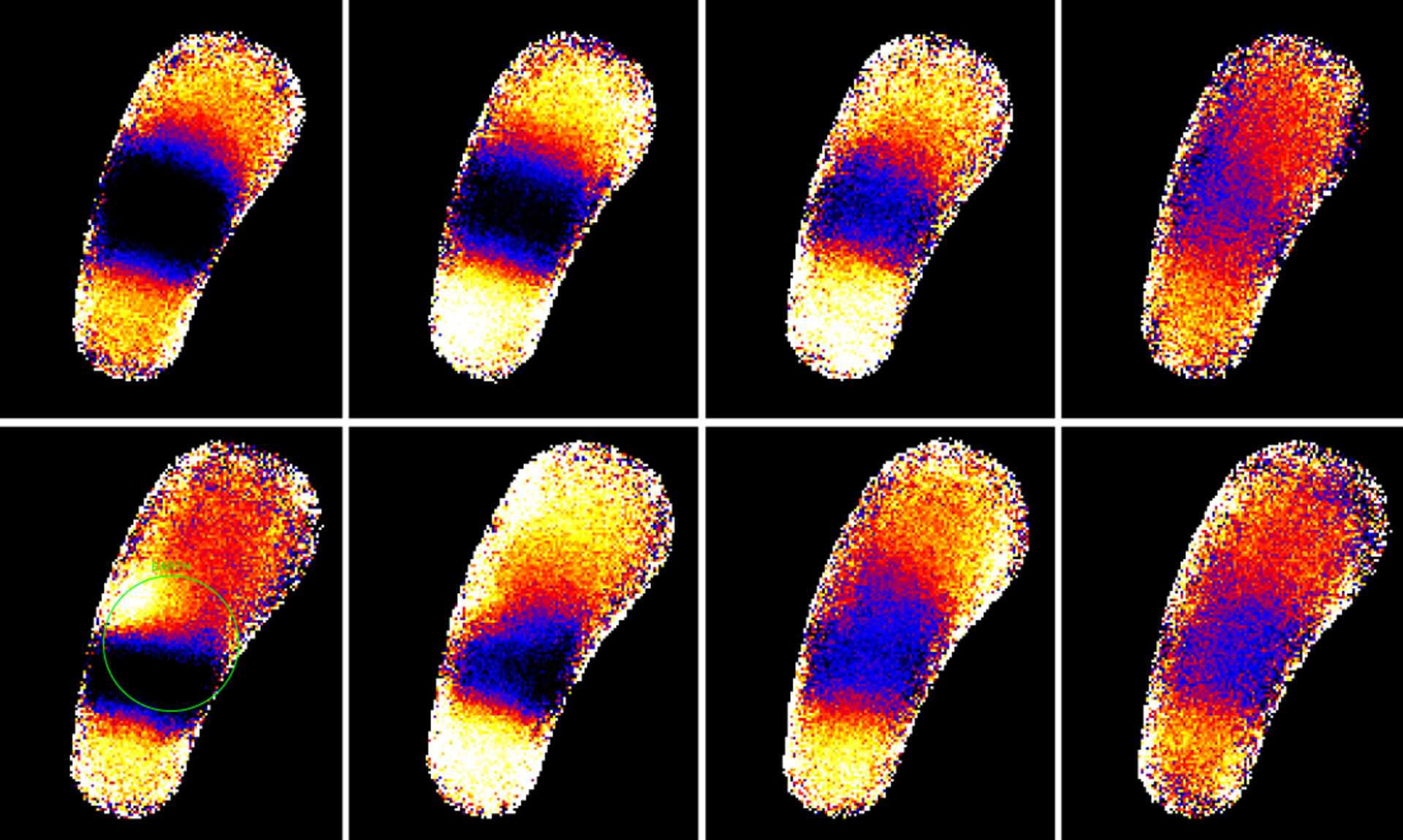 X-ray images of Earth and cosmic X-ray background