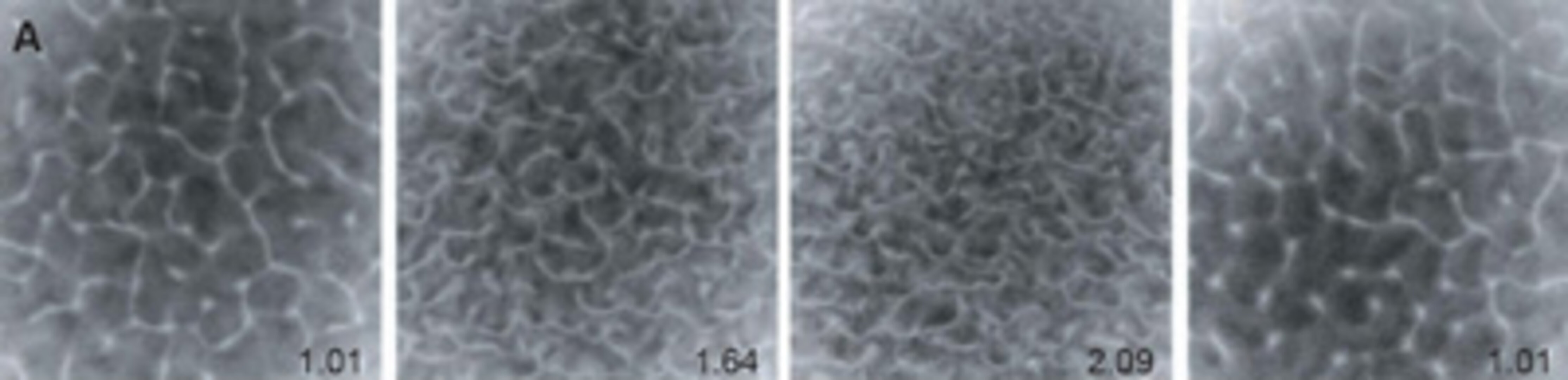 Plan view of steady state bioconvective patterns developed under various gravities & recorded with suspensions of T.thermophila