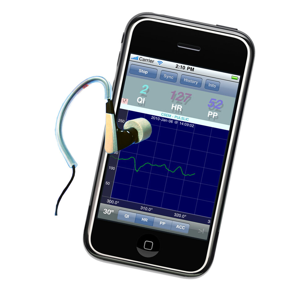 Electrocardiograma