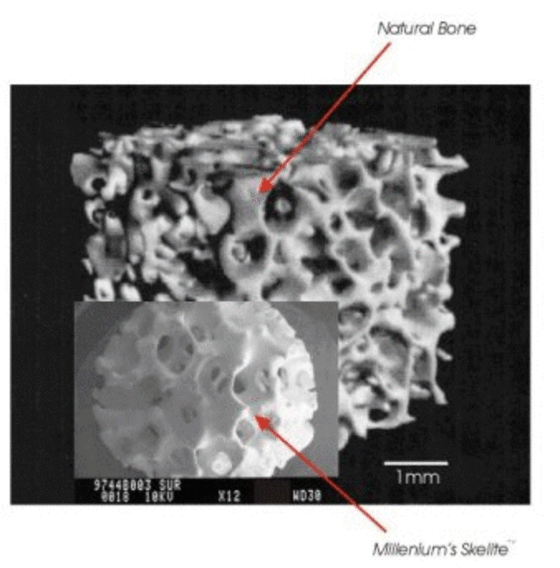 Bone-like Synthetic 3D Scaffolds for Research and Clinical applications.