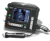 Ultrasound patient monitoring using Tempus Pro