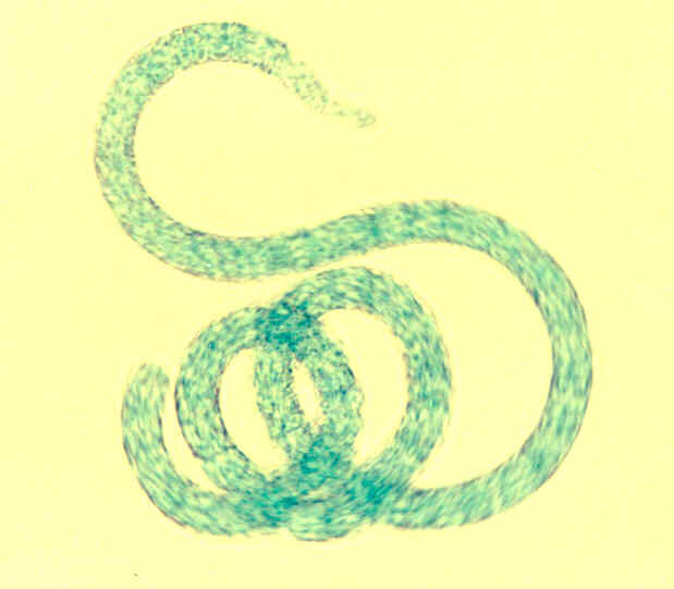 Espirulina