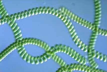 The cyanobacteria Arthrospira platensis also know as 'Spirulina'