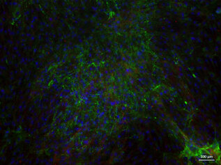 Tendon cells depositing collagen type 1 (green)