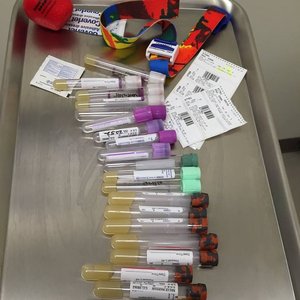 Blood samples from Thomas Pesquet