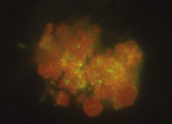 Fluoreszenzmikroskopie-Bilder zeigen die Zellschäden unter verschiedenen Bedingungen. Eine spezielle Färbung markiert die intakten Zellmembranen einer frei im Raum schwebenden Probe in grün.