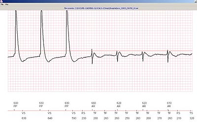 Vital signals can be reviewed remotely