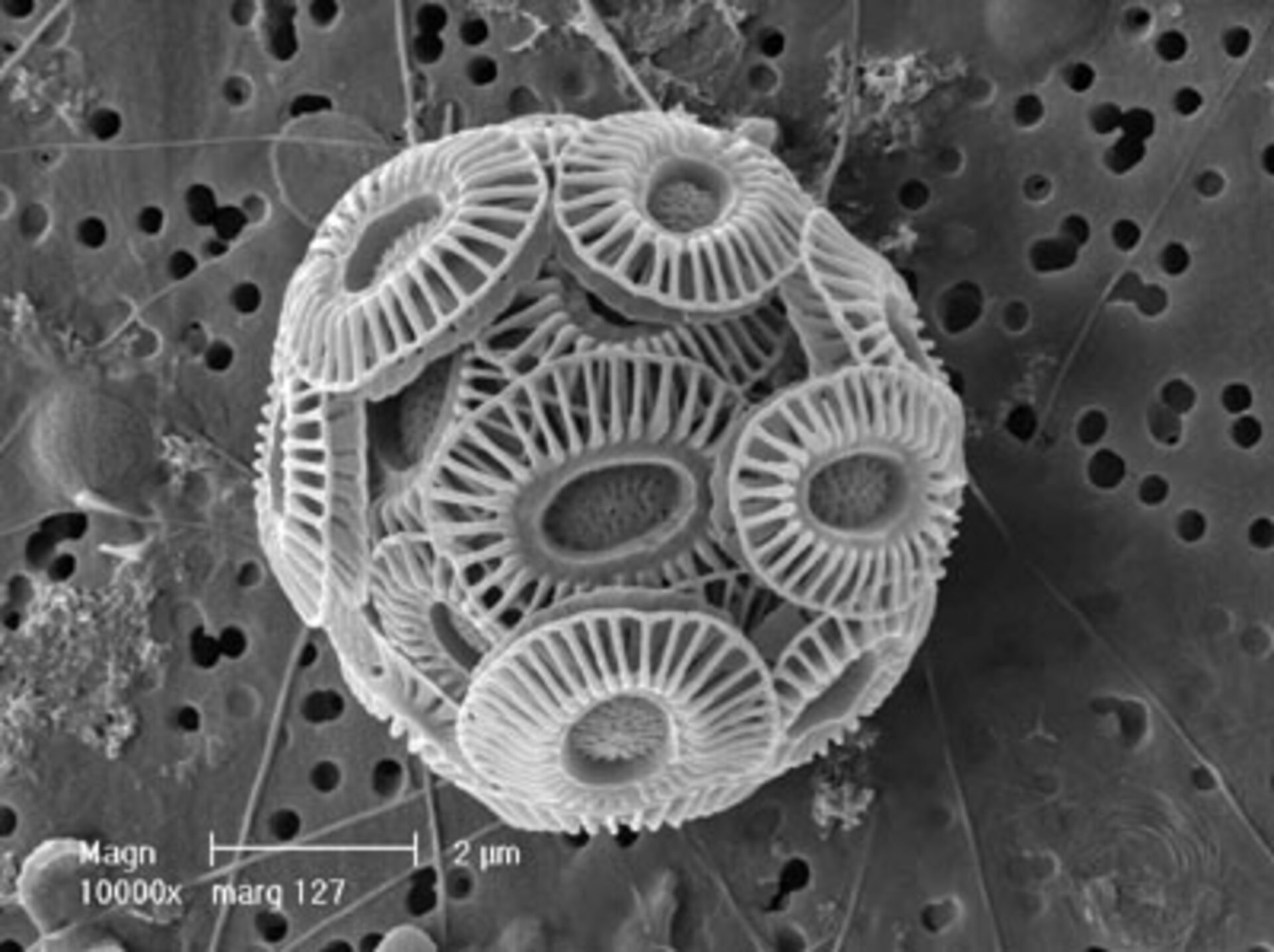 A single <i>Ehux</i> phytoplankton and its shell