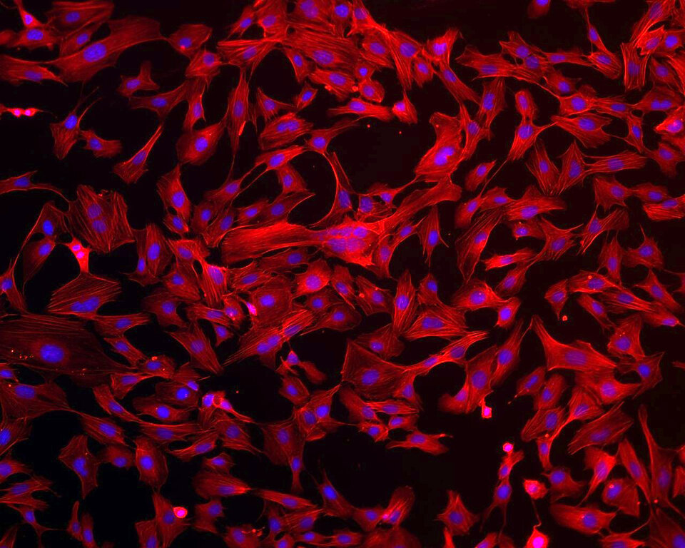 Human endothelial cells 