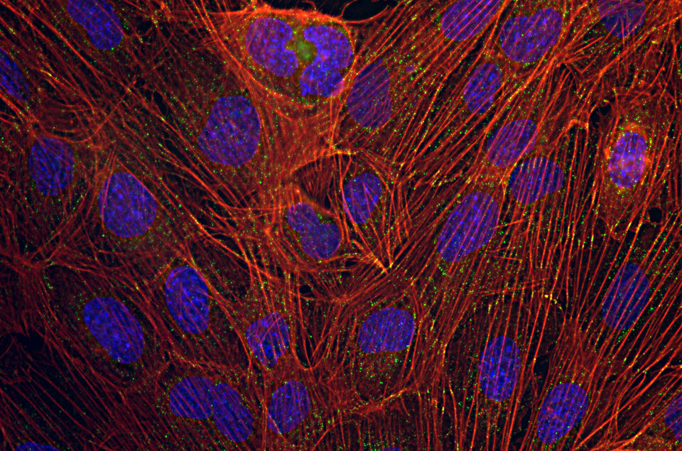 Human endothelial cells 