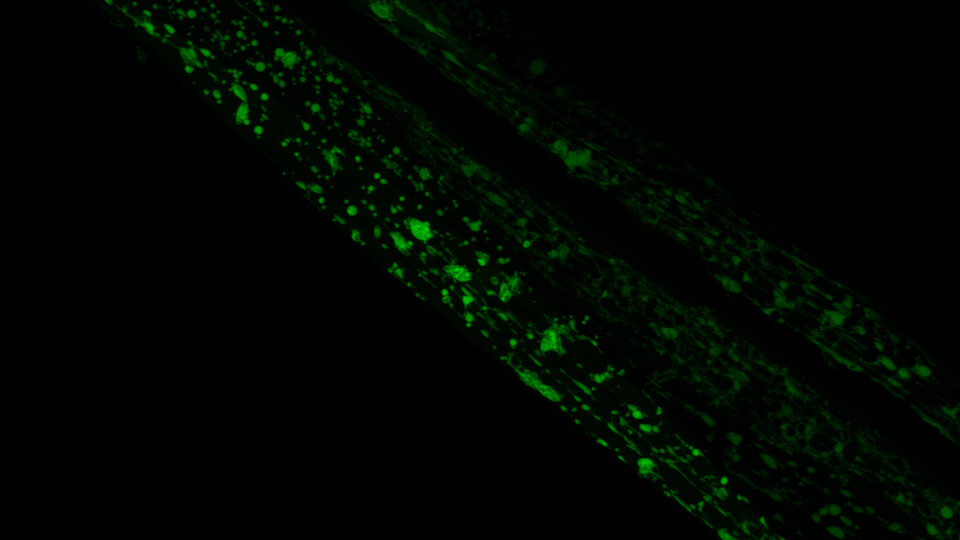 Mitochondrial network deterioration in muscles of aged worms