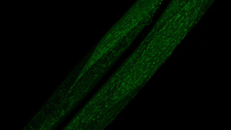 Mitochondrial network of young worms