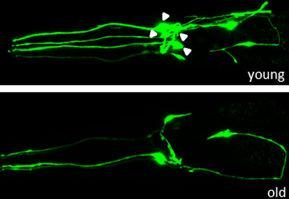 Neuronal deterioration of worms during ageing