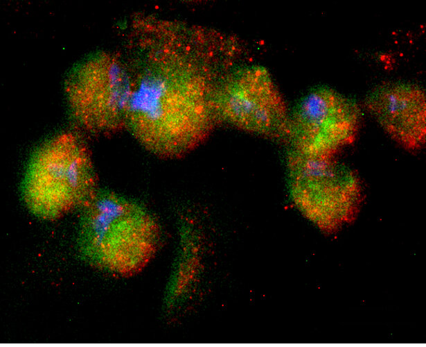 Endothelial cells