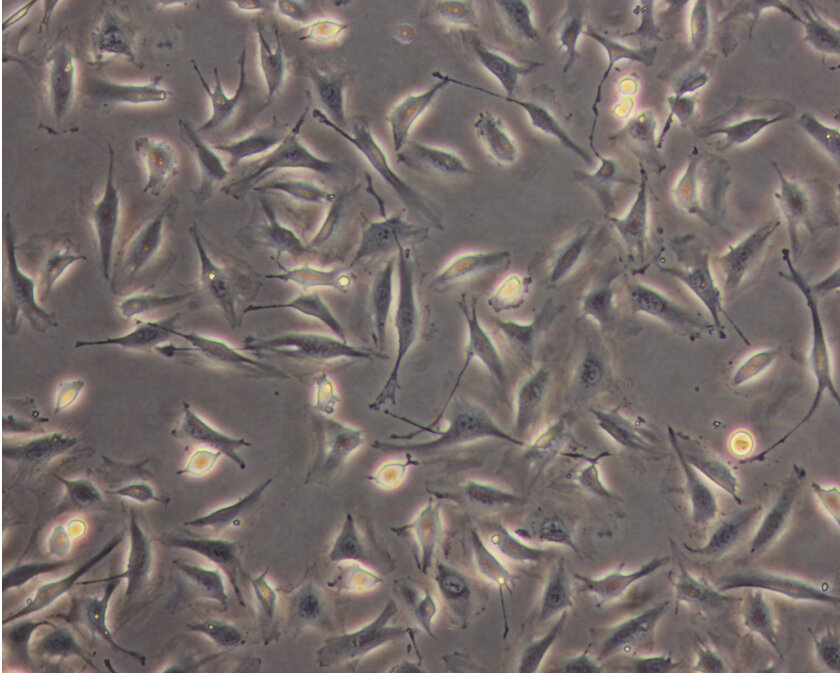 Endothelial cells