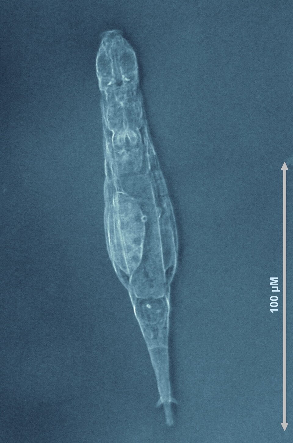 Adineta vaga rotifer