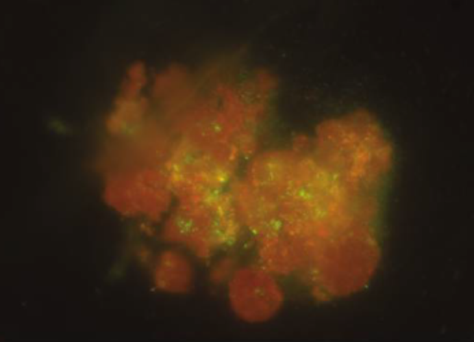 Fluorescence microscopy pictures reveal cell damage under different conditions.