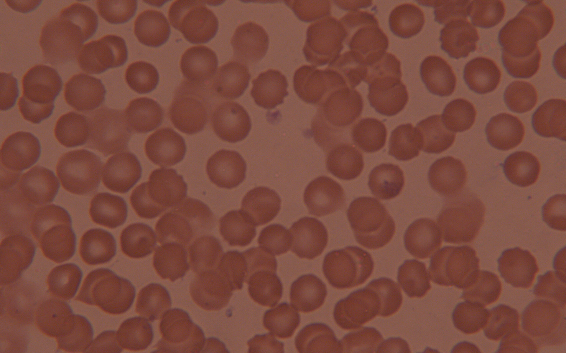 Red blood cells undergoing hemolysis after hypergravity exposure