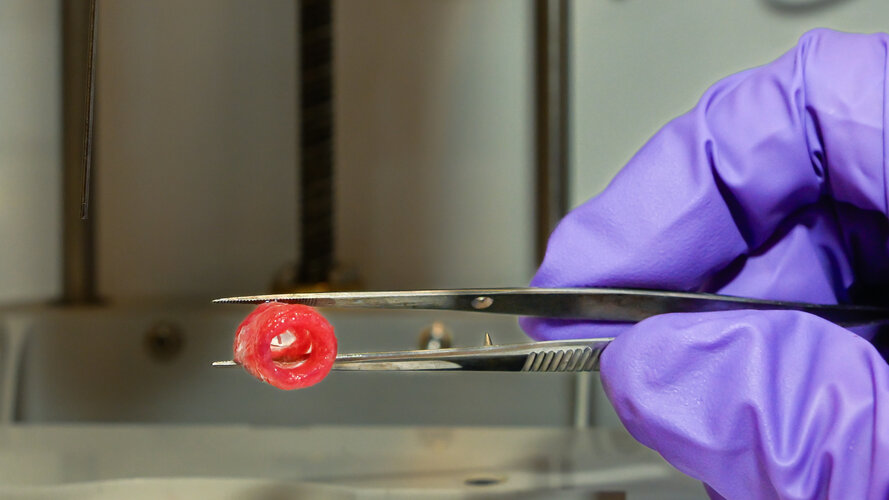 3D-bioprinted blood vessel